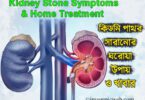 Kidney stone tips bengali কিডনিতে পাথর